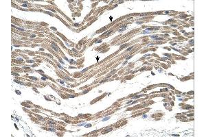 C1QB antibody was used for immunohistochemistry at a concentration of 4-8 ug/ml. (C1QB 抗体  (C-Term))
