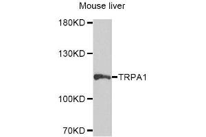 Western blot analysis of extracts of mouse liver, using TRPA1 antibody (ABIN5996346) at 1/1000 dilution. (TRPA1 抗体)