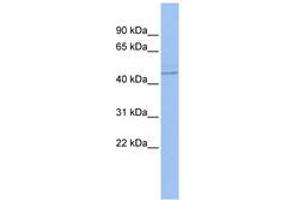 Image no. 1 for anti-Promyelocytic Leukemia (PML) (AA 35-84) antibody (ABIN6742751) (PML 抗体  (AA 35-84))