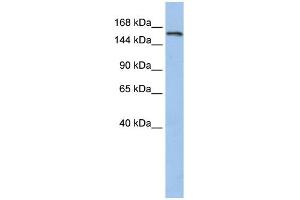 WB Suggested Anti-UBE3A Antibody Titration:  0. (ube3a 抗体  (N-Term))