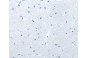 Immunohistochemistry (IHC) image for anti-Neurofascin (NFASC) antibody (ABIN1873888) (NFASC 抗体)