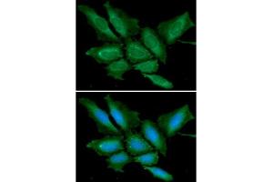 ICC/IF analysis of BPGM in HeLa cells line, stained with DAPI (Blue) for nucleus staining and monoclonal anti-human BPGM antibody (1:100) with goat anti-mouse IgG-Alexa fluor 488 conjugate (Green). (BPGM 抗体)