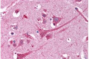 Human Brain, Cortex (formalin-fixed, paraffin-embedded) stained with NEK9 antibody ABIN218339 at 1:50 followed by biotinylated goat anti-rabbit IgG secondary antibody ABIN481713, alkaline phosphatase-streptavidin and chromogen. (NEK9 抗体)