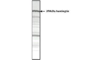 Total protein extract of normal human cerebral cortex separated as a strip on a 3-12. (Huntingtin 抗体  (AA 2703-2911))