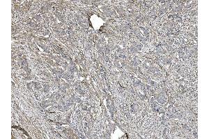 IHC analysis of Filamin A/FLNA using anti-Filamin A/FLNA antibody (ABIN7601783).