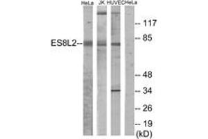 Western blot analysis of extracts from HeLa/Jurkat/HuvEc cells, using ES8L2 Antibody.