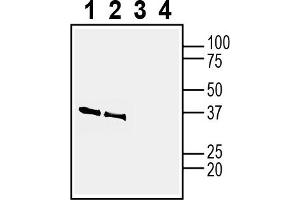 anti-Nicotinamide Nucleotide Adenylyltransferase 2 (NMNAT2) (AA 131-146), (Intracellular) antibody