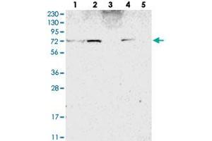 Western blot analysis of Lane 1: RT-4, Lane 2: U-251 MG, Lane 3: Human Plasma, Lane 4: Liver, Lane 5: Tonsil with ZNF846 polyclonal antibody . (ZNF846 抗体)