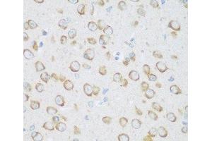 Immunohistochemistry of paraffin-embedded Mouse brain using DHODH Polyclonal Antibody at dilution of 1:100 (40x lens). (DHODH 抗体)