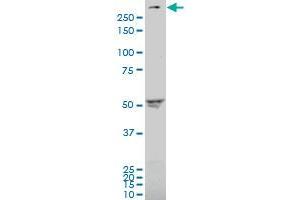 Western Blotting (WB) image for anti-ATP-Binding Cassette, Sub-Family A (ABC1), Member 4 (ABCA4) (AA 2174-2273) antibody (ABIN559734)