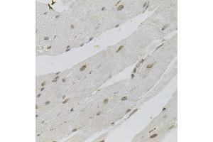 Immunohistochemistry of paraffin-embedded mouse heart using SRSF9 antibody (ABIN5973601) (40x lens). (SFRS9 抗体)