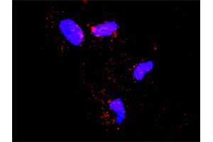 Proximity Ligation Analysis of protein-protein interactions between SMURF1 and ECSIT. (SMURF1 抗体  (AA 1-731))