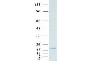 Validation with Western Blot
