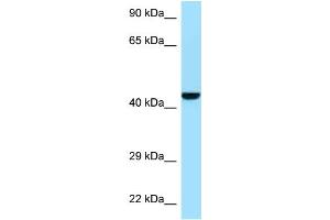WB Suggested Anti-Gmppb Antibody   Titration: 1. (GMPPB 抗体  (N-Term))
