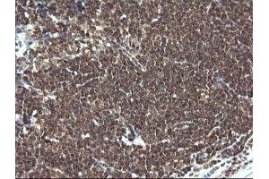 Image no. 4 for anti-Leucine Zipper and CTNNBIP1 Domain Containing (LZIC) antibody (ABIN1499239)