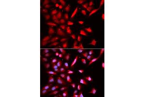 Immunofluorescence analysis of U2OS cells using PSMC3 antibody. (PSMC3 抗体  (AA 1-180))