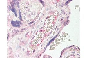 Anti-TEM7 antibody IHC of human placenta. (PLXDC1 抗体  (AA 74-123))