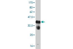 Western Blot detection against Immunogen (37. (FGFR1 抗体  (AA 303-408))
