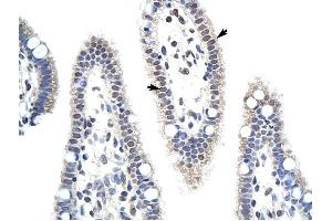 MDS032 antibody was used for immunohistochemistry at a concentration of 4-8 ug/ml to stain Epithelial cells of intestinal villus (arrows) in Human Intestine. (Use1 抗体  (N-Term))