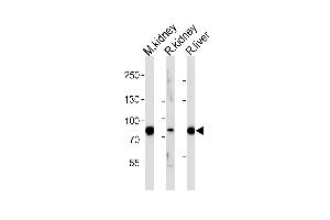 Western blot analysis of lysates from mousr kidney, rat kidney and liver tissue (from left to right), using EHHADH Antibody (C-term) (ABIN652576 and ABIN2842388). (EHHADH 抗体  (C-Term))