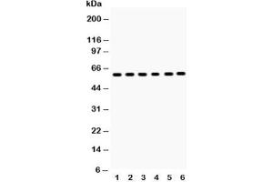Western blot testing of EAAT2 antibody and Lane 1:  rat brain;  2: mouse brain;  3: U87;  4: SMMC-7721;  5: PANC;  6: A549;  Predicted size: 62KD;  Observed size: 62KD (SLC1A2 抗体  (AA 461-574))