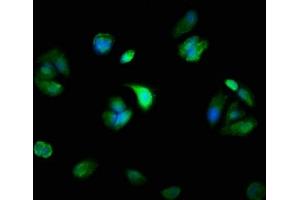 Immunofluorescence staining of MCF-7 cells with ABIN7160568 at 1:100, counter-stained with DAPI. (Myosin 抗体  (AA 1058-1195))