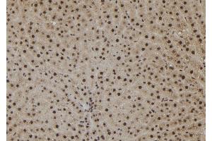 ABIN6265380 and ABIN6273078 at 1/100 staining Rat liver tissue by IHC-P. (SHoc2/Sur8 抗体  (C-Term))