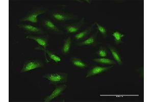 Immunofluorescence of purified MaxPab antibody to STOM on HeLa cell. (Stomatin 抗体  (AA 1-288))