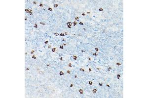Immunohistochemistry of paraffin-embedded human tonsil using CD8A Rabbit mAb (ABIN1512846, ABIN3021030, ABIN3021031 and ABIN7101333) at dilution of 1:100 (40x lens). (CD8 alpha 抗体)