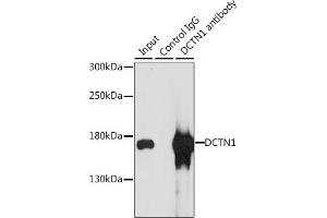 Immunoprecipitation analysis of 200 μg extracts of MCF-7 cells, using 3 μg DCTN1 antibody (ABIN3022541, ABIN3022542, ABIN3022543 and ABIN6218891). (Dynactin 1 抗体  (AA 945-1139))