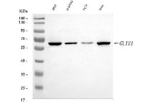 Western blot analysis of GLIS1 using anti-GLIS1 antibody (ABIN7599501).