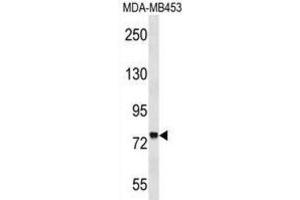 Western Blotting (WB) image for anti-Zinc Finger Protein 16 (ZNF16) antibody (ABIN2999236) (ZNF16 抗体)
