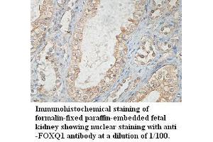 Image no. 1 for anti-Forkhead Box Q1 (FOXQ1) antibody (ABIN791229) (FOXQ1 抗体)