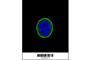 Confocal immunofluorescent analysis of IL10RA Antibody with MCF-7 cell followed by Alexa Fluor 488-conjugated goat anti-rabbit lgG (green). (IL-10RA 抗体  (AA 147-175))