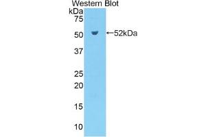 Western blot analysis of the recombinant protein. (Kallikrein 7 抗体  (AA 30-249))