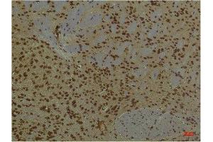 Immunohistochemistry (IHC) analysis of paraffin-embedded Mouse Brain Tissue using PI3 Kinase P85 alpha Mouse Monoclonal Antibody diluted at 1:200. (PIK3R1 抗体)