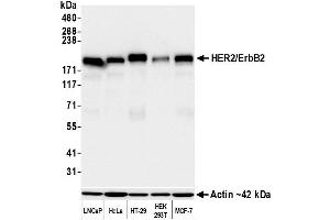 Western Blotting (WB) image for anti-Receptor tyrosine-protein kinase erbB-2 (ErbB2/Her2) (AA 1205-1255) antibody (ABIN7455181) (Recombinant ErbB2/Her2 抗体  (AA 1205-1255))