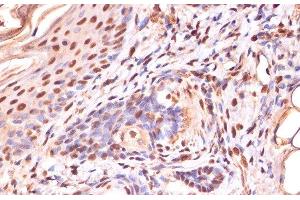Immunohistochemistry of paraffin-embedded Human skin using Phospho-β-catenin(S33/S37/T41) Polyclonal Antibody at dilution of 1:100 (40x lens). (beta Catenin 抗体  (pSer33, pSer37, pThr41))