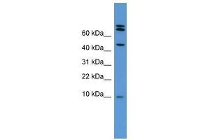 Bmp2 antibody used at 0. (BMP2 抗体  (Middle Region))