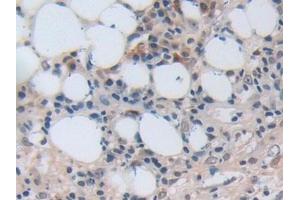 Immunohistochemistry (IHC) image for anti-Nucleoporin 50kDa (NUP50) (AA 37-269) antibody (ABIN7442900)