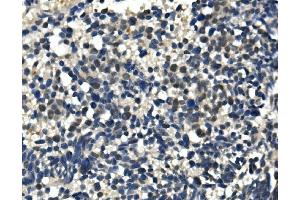 IHC analysis of ULK1 using anti-ULK1 antibody (ABIN7602755).