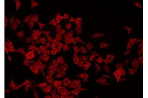 ABIN6266853 staining HuvEc by IF/ICC. (Transglutaminase 2 抗体  (N-Term))