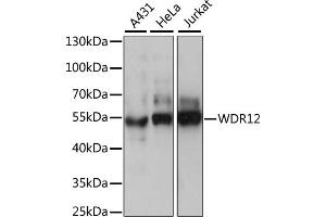 Western blot analysis of extracts of various cell lines, using WDR12 antibody (ABIN7271353) at 1:1000 dilution. (WDR12 抗体  (AA 1-280))