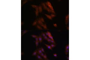 Immunofluorescence analysis of C6 cells using Presenilin 1 Rabbit pAb (ABIN3023159, ABIN3023160, ABIN3023161 and ABIN6219418) at dilution of 1:100 (40x lens).