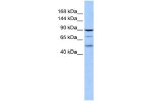 Western Blotting (WB) image for anti-Hairless (HR) antibody (ABIN2460608) (Hairless 抗体)