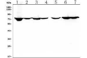 Western blot analysis of HIF3A using anti-HIF3A antibody (ABIN7601137).