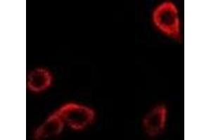 Immunofluorescent analysis of RRM1 staining in Hela cells. (RRM1 抗体)