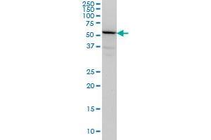 TULP2 monoclonal antibody (M03), clone 2B5 Western Blot analysis of TULP2 expression in HeLa . (TULP2 抗体  (AA 141-250))