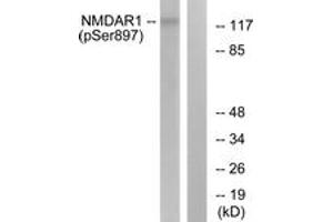 Western blot analysis of extracts from LOVO cells, using NMDAR1 (Phospho-Ser897) Antibody. (GRIN1/NMDAR1 抗体  (pSer897))