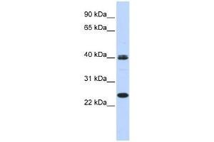 MESP1 antibody used at 0. (MESP1 抗体  (N-Term))